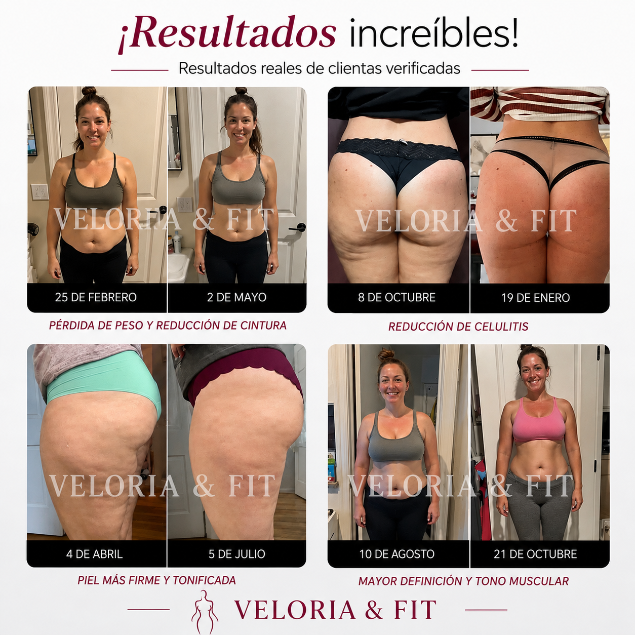 Mallas anticelulíticas 3D®
